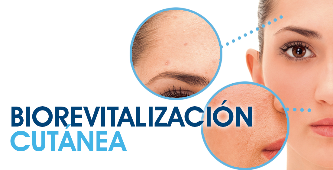 biorevitalizacion cutanea