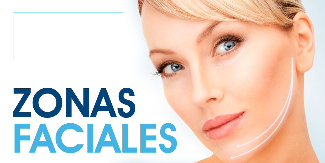 hilos tensores faciales