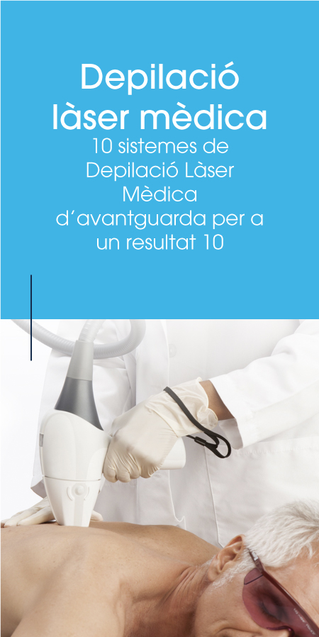 depilacio laser