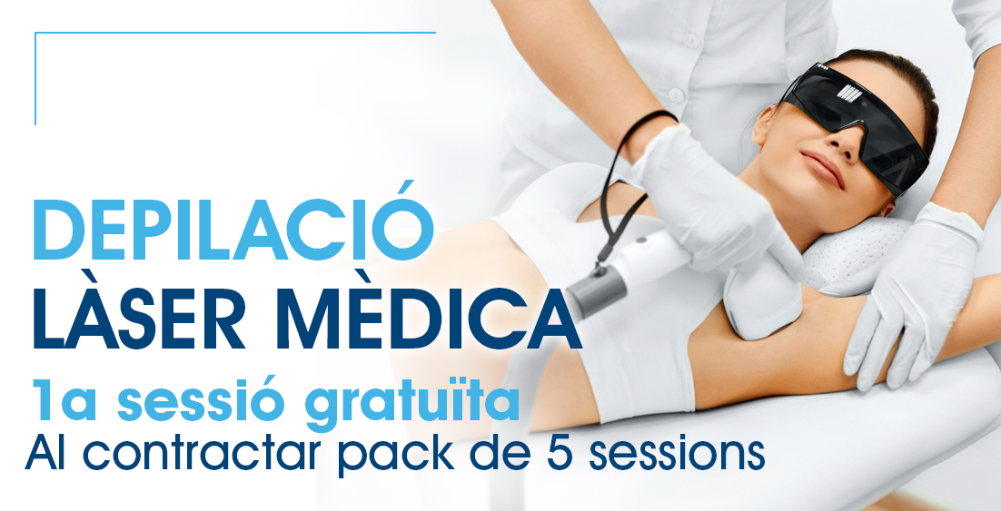depilació laser